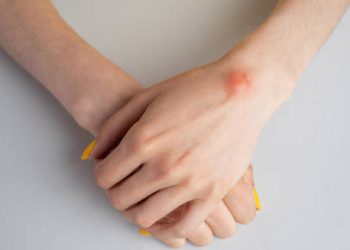 Complications of Lipoma