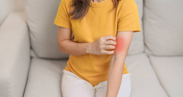 Complications of Lupus