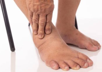 Complications of Lymphoedema