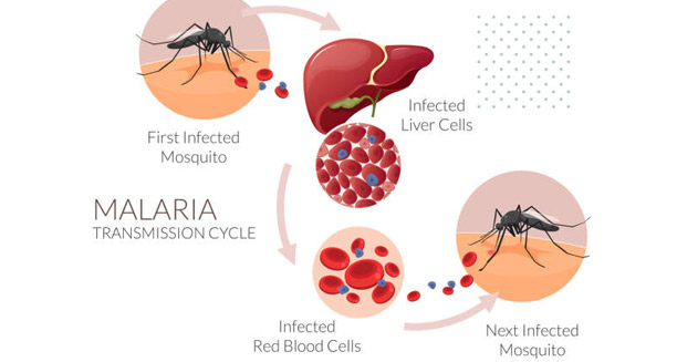 Complications of Malaria