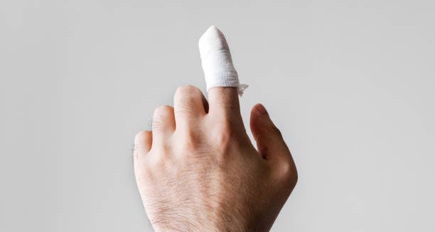 Complications of Mallet Finger