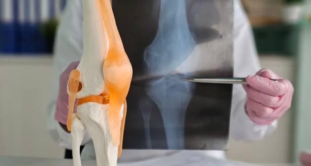 Diagnosis of Knee Cartilage Damage
