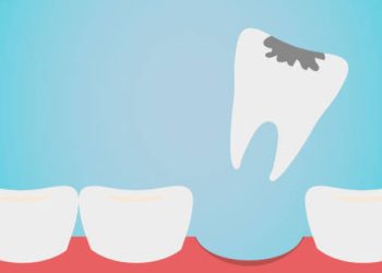Diagnosis of Knocked-Out Tooth