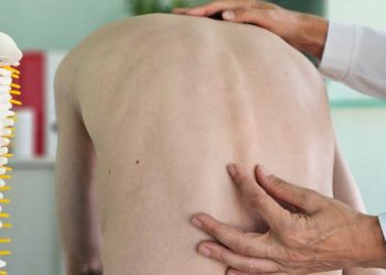 Diagnosis of Kyphosis