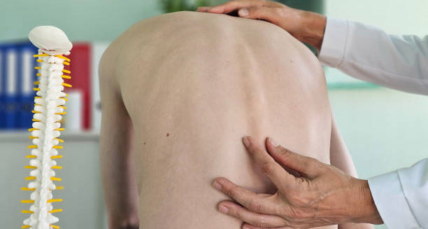 Diagnosis of Kyphosis