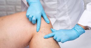 Diagnosis of Leg Ulcer
