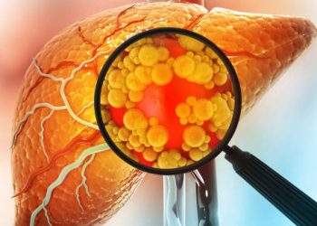 Diagnosis of Liver Cancer