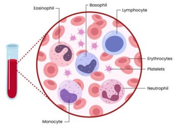 Diagnosis of Low White Blood Cell Count