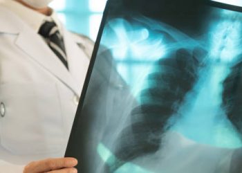 Diagnosis of Lung Cancer