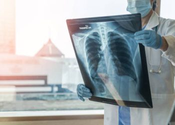 Diagnosis of Lung Disease