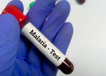 Diagnosis of Malaria