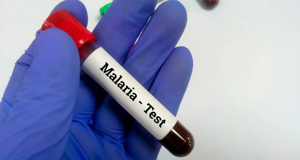 Diagnosis of Malaria