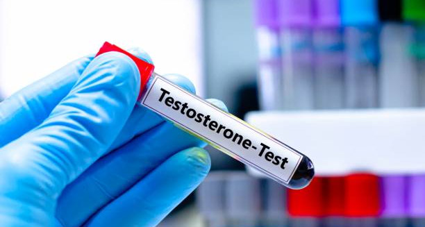Diagnosis of Male Menopause
