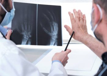 Diagnosis of Mallet Finger