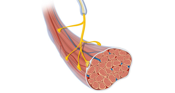 Overview of Lambert-Eaton myasthenic syndrome