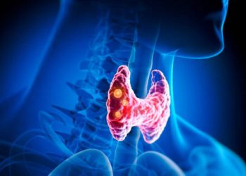 Overview of Laryngeal (larynx) cancer