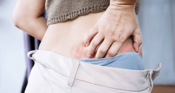 Overview of Lichen Sclerosus