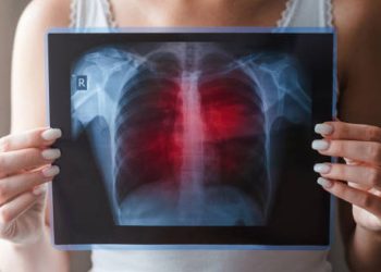Overview of Lung Disease