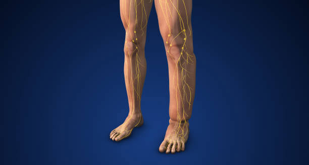 Overview of Lymphoedema