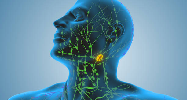 Overview of Lymphoma