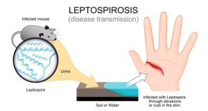 Overview of Leptospirosis