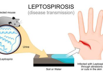 Overview of Leptospirosis