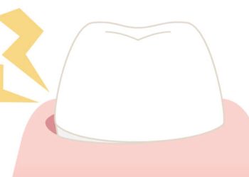 Symptoms of Knocked-Out Tooth