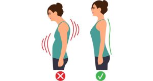 Symptoms of Kyphosis