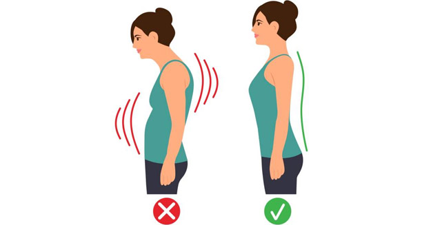 Symptoms of Kyphosis