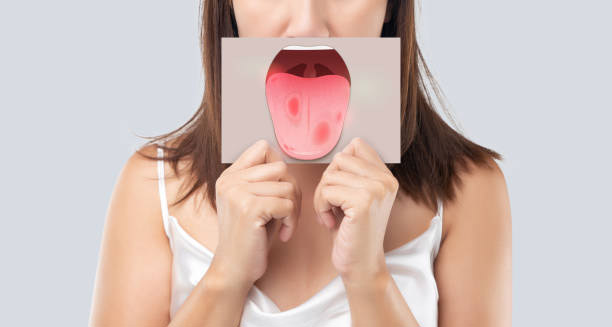 Symptoms of Leukoplakia