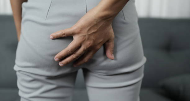 Symptoms of Lichen Sclerosus