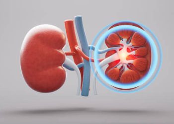 3D rendering of kidney with highlighted infection area under treatment