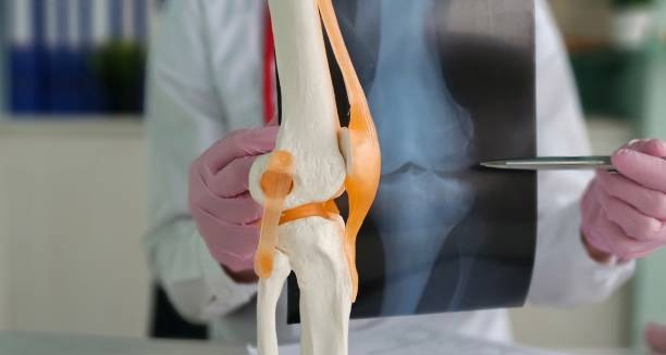 Treatment of Knock Knees