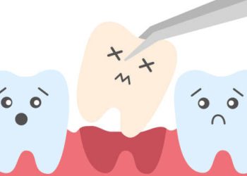 Treatment of Knocked-Out Tooth