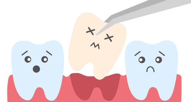 Treatment of Knocked-Out Tooth