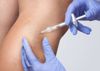 Treatment of Leg Ulcer