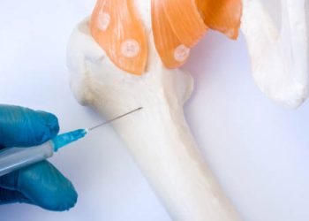 Treatment of Leukaemia