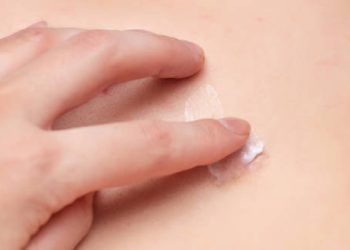 Treatment of Lichen Sclerosus