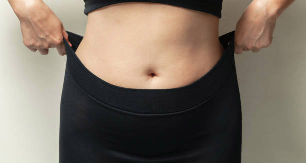 Treatment of Lipoedema