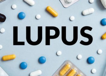 Treatment of Lupus
