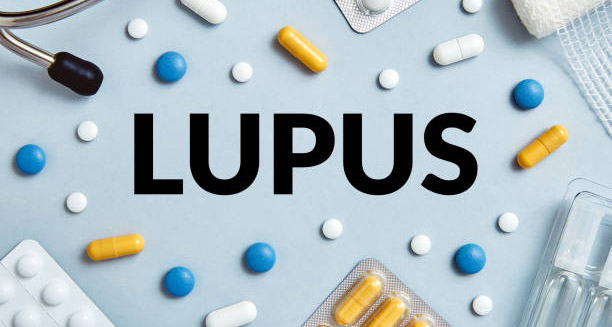 Treatment of Lupus
