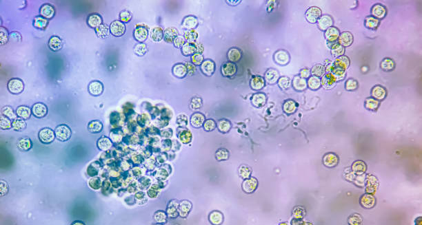 Causes of Maple Syrup Urine Disease