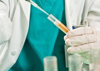 Diagnosis of Maple Syrup Urine Disease