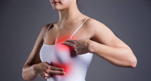 Overview of Mastitis