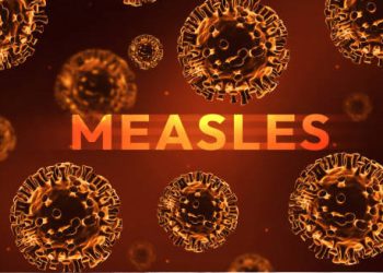 Causes of Measles