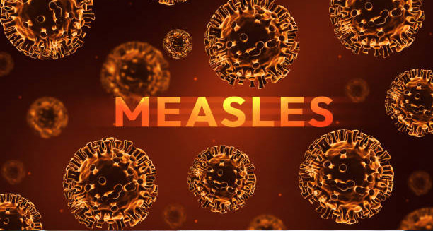 Causes of Measles