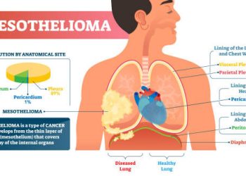 Overview of Mesothelioma