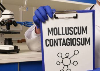 Treatment of Molluscum Contagiosum